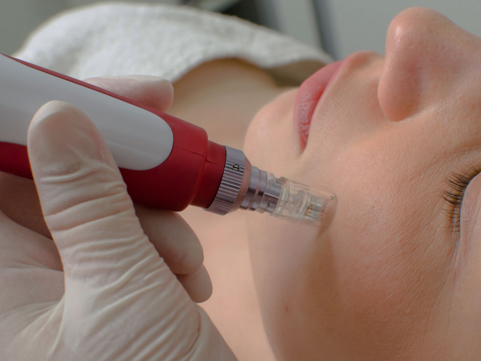 Dermapen Dermapen